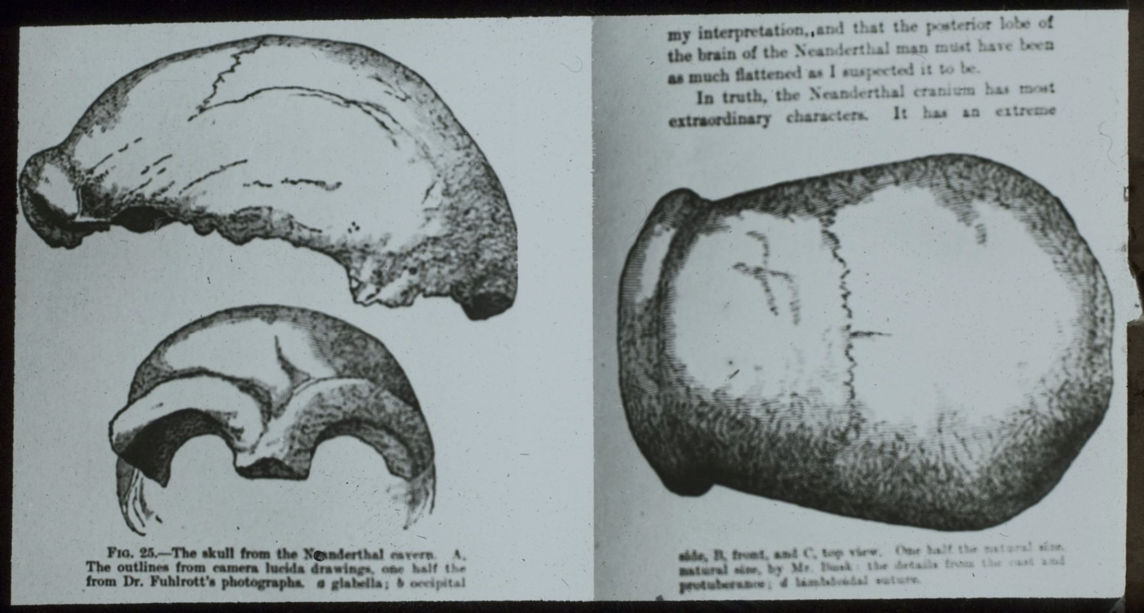 Textbook Drawing of a Neanderthal Skull